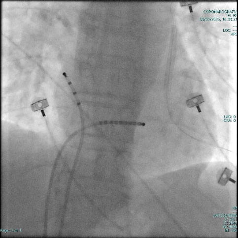 Elettrofisiologia cardiologia Vallo della Lucania