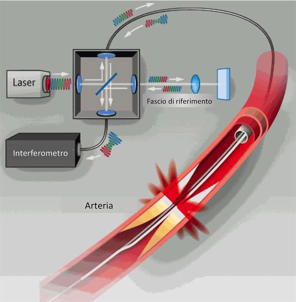 Optimal Coherence Tomography vallo della lucania